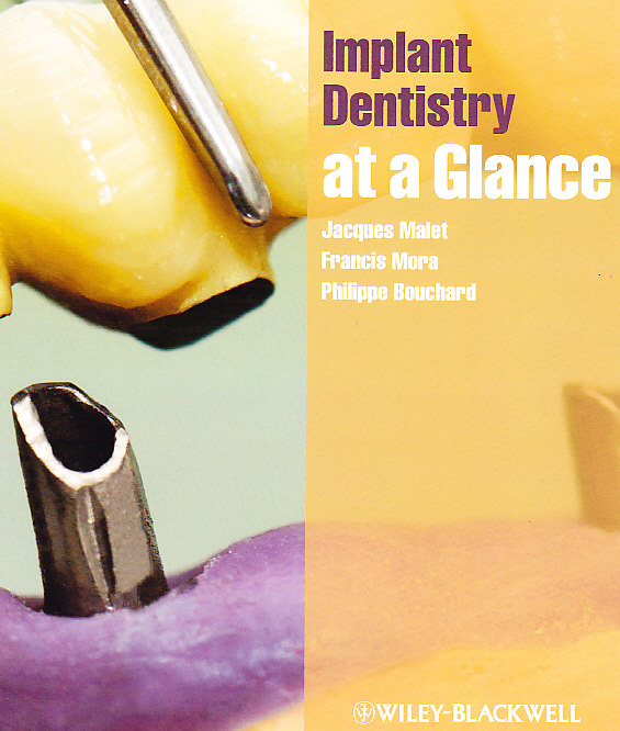 Implant Dentistry at a Glance