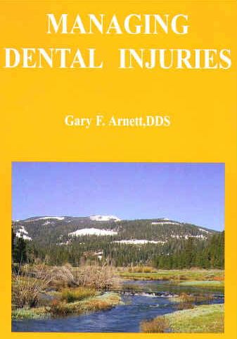 Managing Dental Injuries