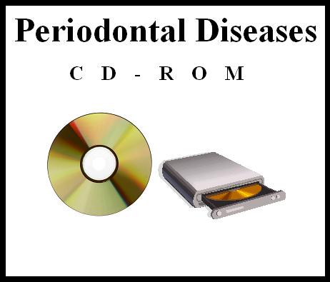 CD-ROM: Periodontal Diseases