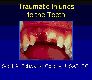 Tooth Trauma - Online Slides